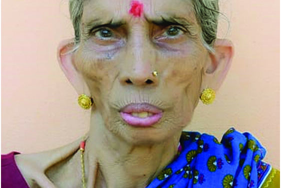 ನಿಧನ  ಲಕ್ಷ್ಮೀ ಭಂಡಾರಿ